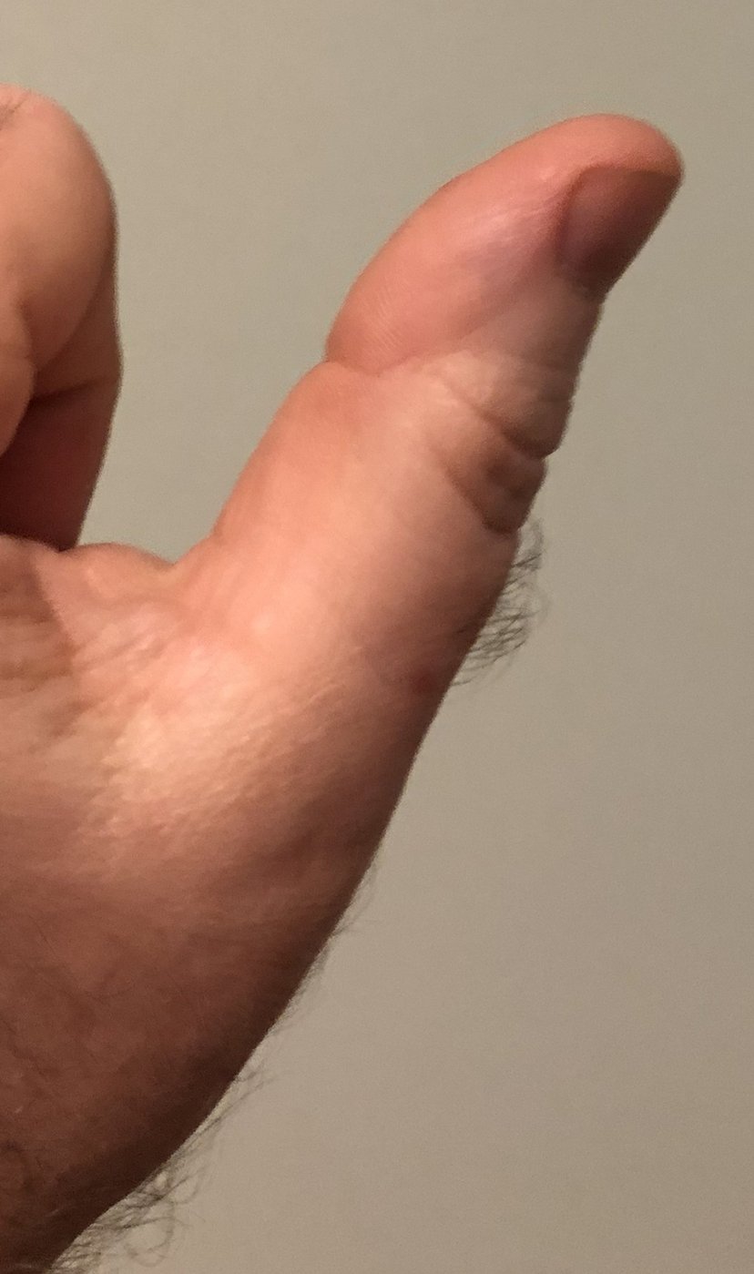 Larry Sanger's left thumb