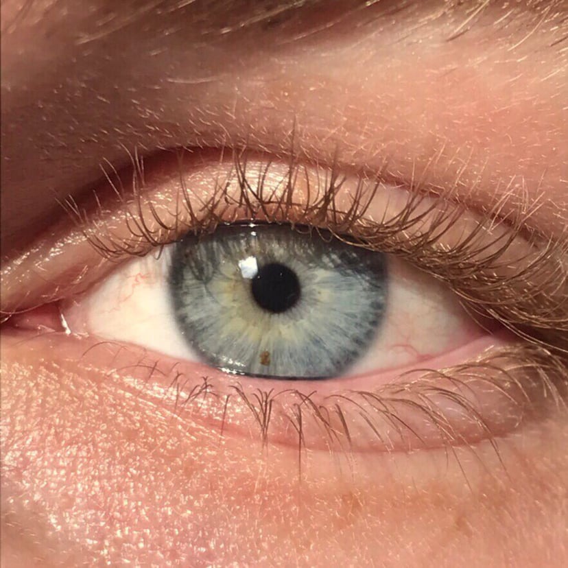 Eye color
