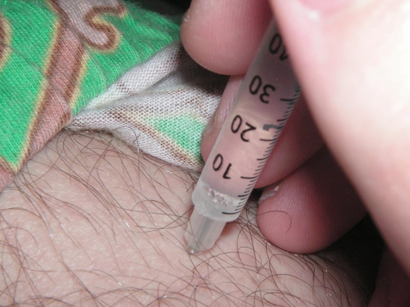 Intramuscular injection