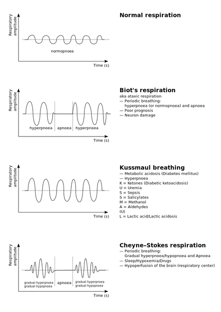 Cheyne–Stokes respiration