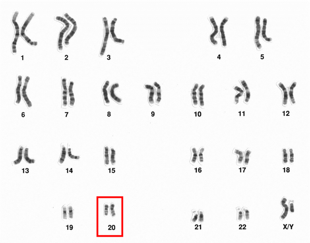 Chromosome 20 (human)