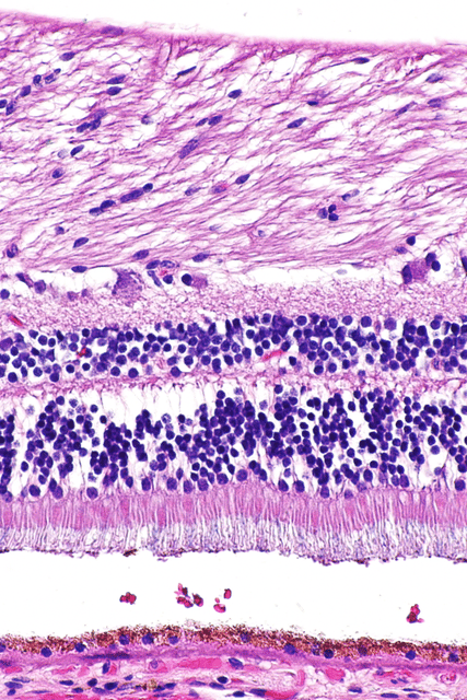 H&E stain