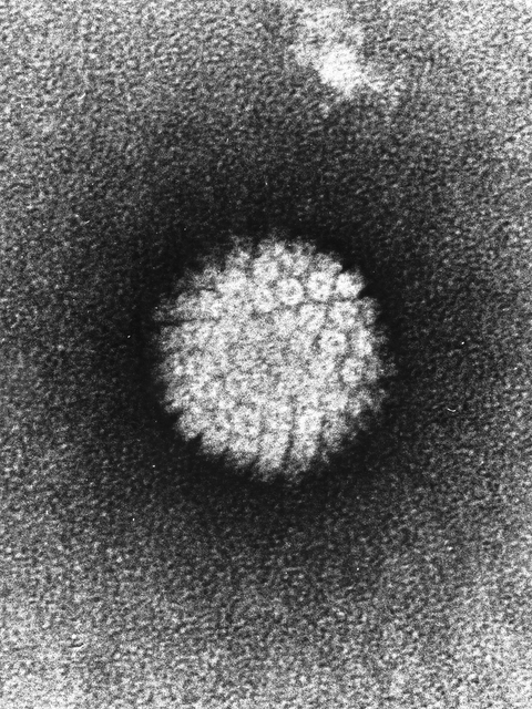 Human papillomavirus