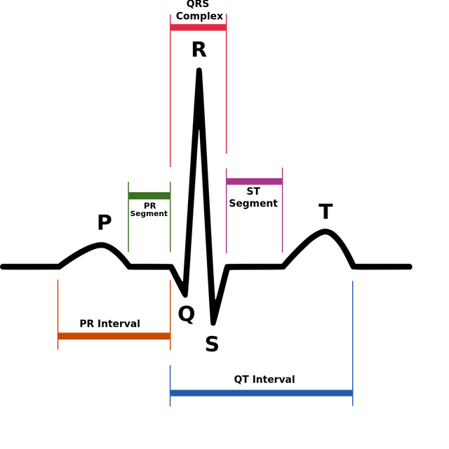 Long QT syndrome