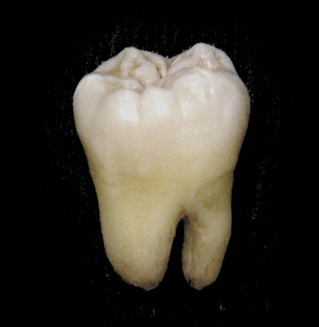 Molar (tooth)