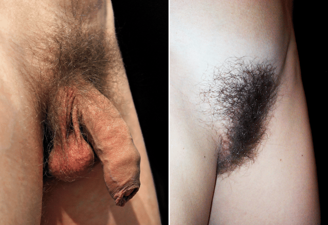 Pubic hair