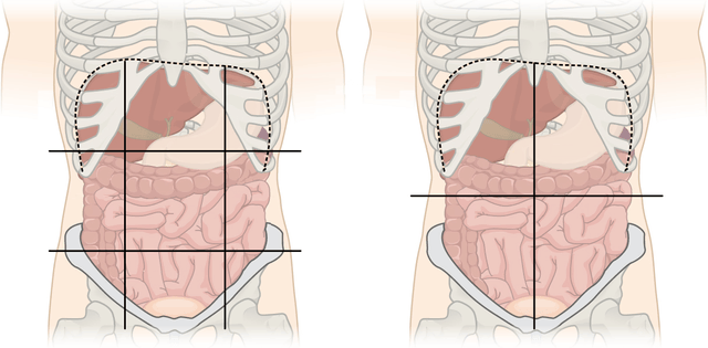 Quadrant (abdomen)