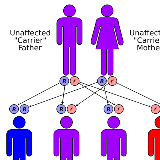 Weissenbacher–Zweymüller syndrome