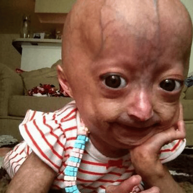 Adalia Rose