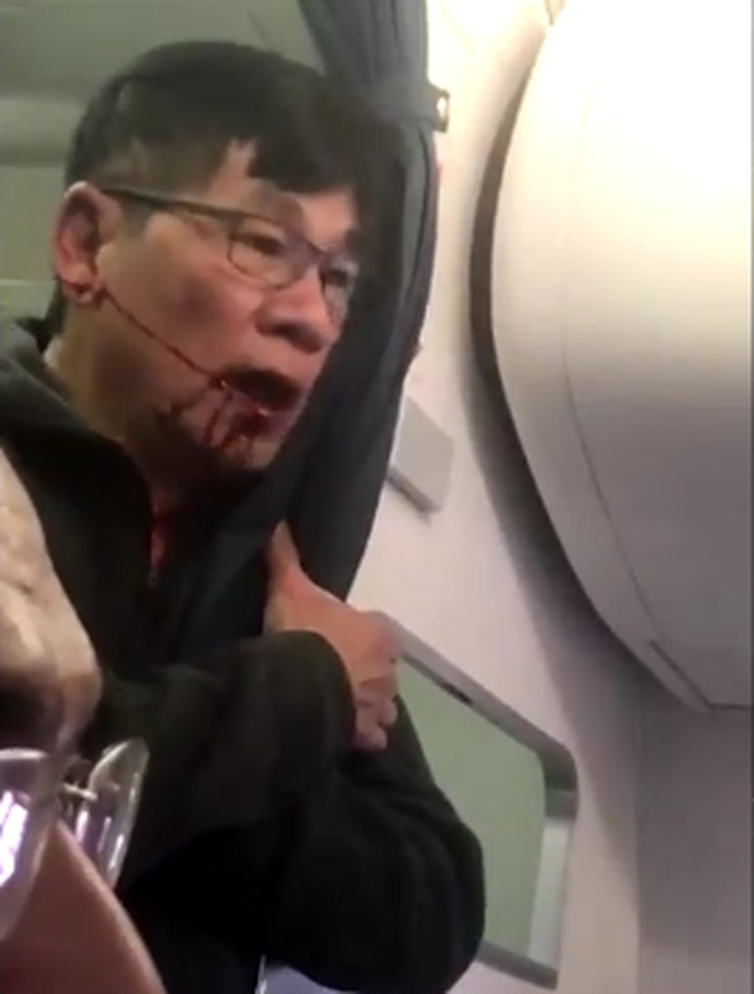 Asian Doctor (United Flight 3411)