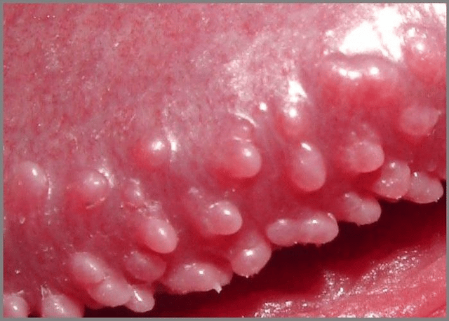 Common skin disorders of the penis