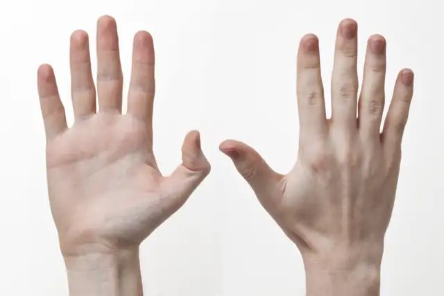 Hand
