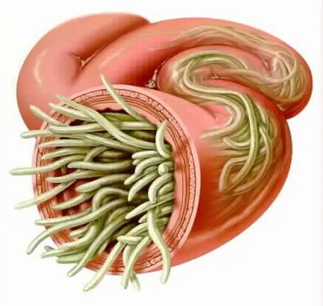 ICD-10: Intestinal infectious diseases (A00-A09)