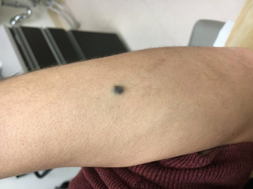 Nikka's Blue Mole