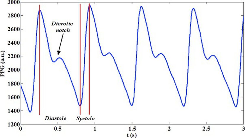 PPG Signal Analysis